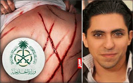 el bloguero saudita Raif Badawi