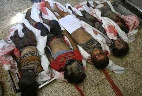 víctimas de la agresión saudí contra la población en Yemen
