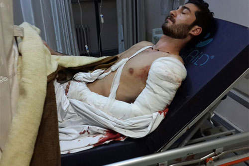 un herido en el ataque terrorista en Estambul